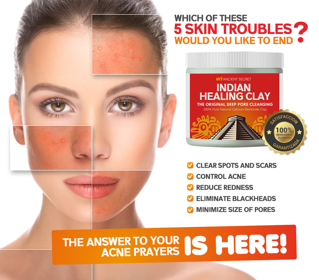 Ancient Secret – Indian Healing Clay 1 lb – Deep Pore Cleansing Facial & Body Mask – The Original 100% Natural Calcium Bentonite Clay